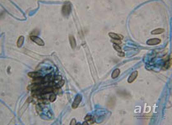 Oberflächenkontaktproben